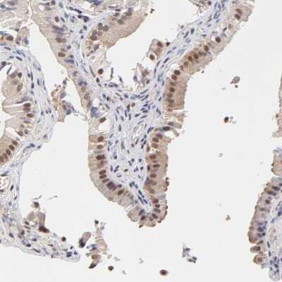 Immunohistochemistry-Paraffin: Tbp7 Antibody [NBP1-87799]