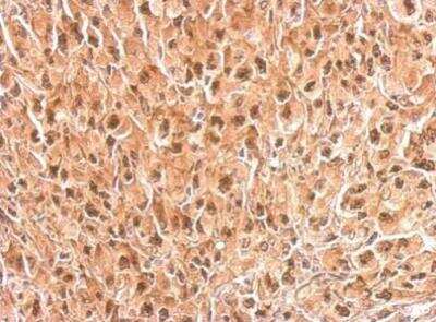 Immunohistochemistry-Paraffin: Tbp7 Antibody [NBP2-20581]