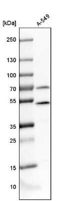Western Blot: Tbp7 Antibody [NBP1-87799]