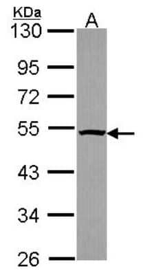 Western Blot: Tbp7 Antibody [NBP2-20581]