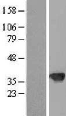 Western Blot: TBX20 Overexpression Lysate [NBP2-10191]