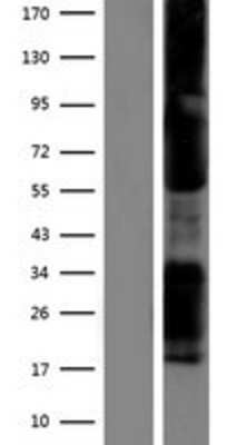 Western Blot: T-bet/TBX21 Overexpression Lysate [NBP2-07419]