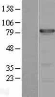 Western Blot: TBX3 Overexpression Lysate [NBL1-16748]