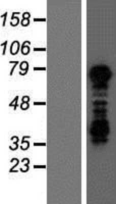 Western Blot: TBX3 Overexpression Lysate [NBP2-09825]