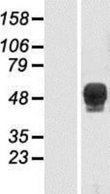 Western Blot: TBX6 Overexpression Lysate [NBP2-07846]