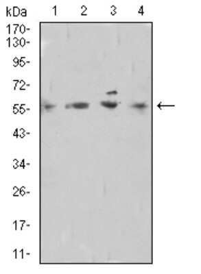 Western Blot: TdT Antibody (4B10A6)BSA Free [NBP2-61899]