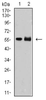Western Blot: TdT Antibody (4B10C3)BSA Free [NBP2-61898]