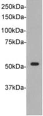 Western Blot: TdT Antibody (B4-F5) [NBP2-67185]