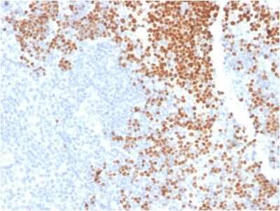 Immunohistochemistry-Paraffin: TdT Antibody (DNTT/1453) - Azide and BSA Free [NBP3-08563]