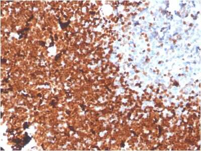 Immunohistochemistry-Paraffin: TdT Antibody (DNTT/1453) [NBP3-07683]