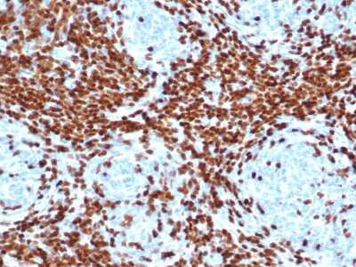 Immunohistochemistry-Paraffin: TdT Antibody (DNTT/4506R) - Azide and BSA Free [NBP3-08564]