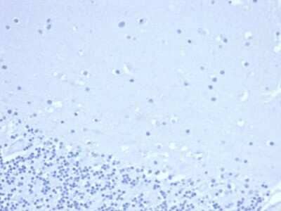 Immunohistochemistry-Paraffin: TdT Antibody (DNTT/4506R) - Azide and BSA Free [NBP3-08564]