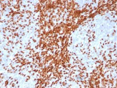 Immunohistochemistry-Paraffin: TdT Antibody (DNTT/4617R) [NBP3-13872]