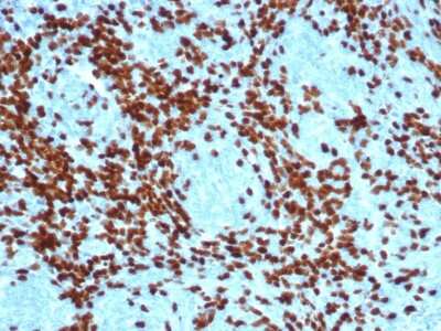 Immunohistochemistry-Paraffin: TdT Antibody (DNTT/4617R) [NBP3-13872]