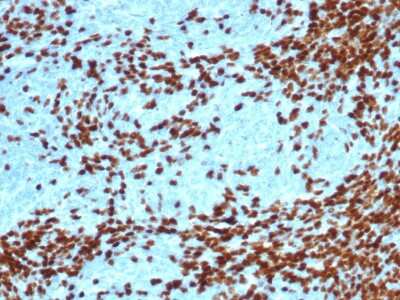 Immunohistochemistry-Paraffin: TdT Antibody (DNTT/4617R) [NBP3-13872]