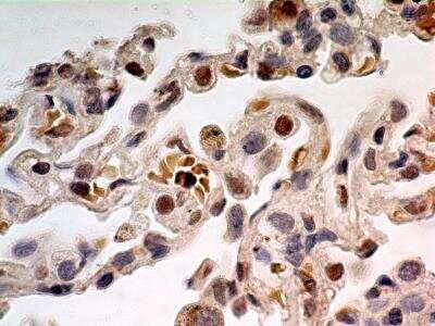Immunohistochemistry-Paraffin: TdT Antibody [NBP2-31368]