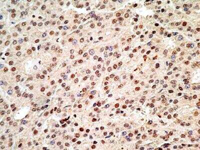 Immunohistochemistry-Paraffin: TdT Antibody [NBP2-31368]