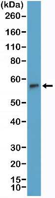 Western Blot: TdT Antibody (RM379) [NBP2-77436]