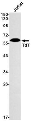 Western Blot: TdT Antibody (S01-1C3) [NBP3-19930]