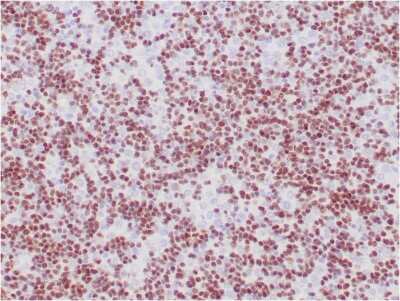 Immunohistochemistry-Paraffin: TdT Antibody (TDT/1393) - Azide and BSA Free [NBP3-08484]