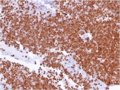 Immunohistochemistry-Paraffin: TdT Antibody (TDT/1393) - Azide and BSA Free [NBP3-08484]