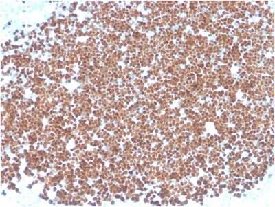 Immunohistochemistry-Paraffin: TdT Antibody (TDT/1393) [NBP3-07673]