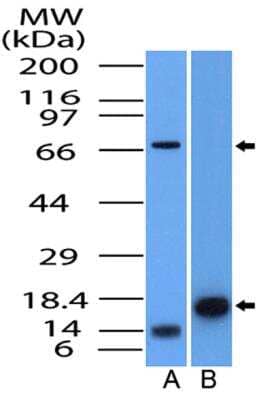 Western Blot: TdT Antibody [NBP2-31368]