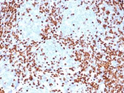 Immunohistochemistry-Paraffin: TdT Antibody (rDNTT/6909) [NBP3-13871]