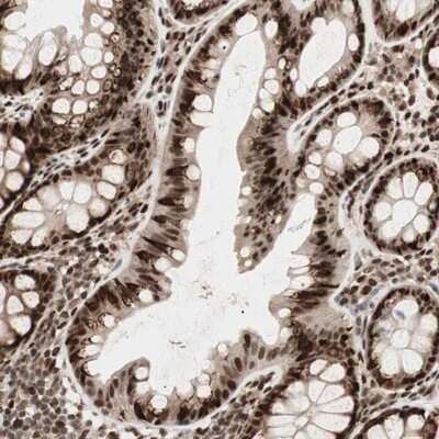 Immunohistochemistry-Paraffin: Teashirt homolog 1 Antibody [NBP1-87377]