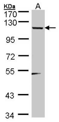 Western Blot: Teashirt homolog 1 Antibody [NBP1-32300]