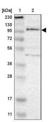 Western Blot: Teashirt homolog 1 Antibody [NBP1-87377]