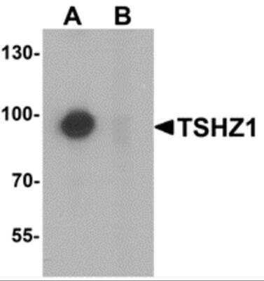 Western Blot: Teashirt homolog 1 AntibodyBSA Free [NBP2-82038]