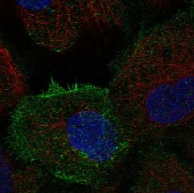 Immunocytochemistry/ Immunofluorescence: Tec Antibody [NBP2-55192]