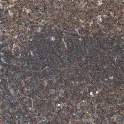 Immunohistochemistry-Paraffin: Tec Antibody [NBP1-87206]