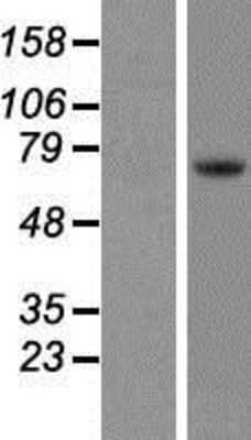 Western Blot: Tec Overexpression Lysate [NBP2-08029]