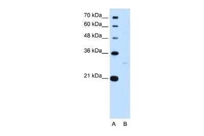 Western Blot: Tef Antibody [NBP2-84300]