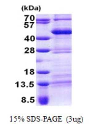 SDS-PAGE: Recombinant Human Tef His Protein [NBP2-22867]