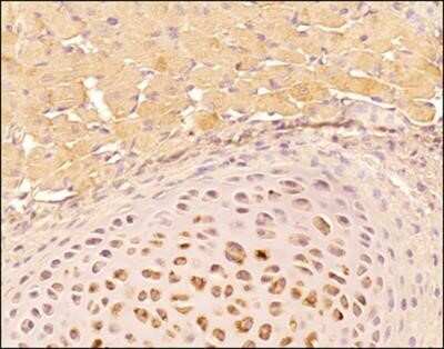 Immunohistochemistry-Paraffin: Tenascin C Antibody (4C8MS) - Azide and BSA Free [NBP2-80973]