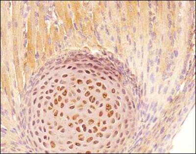Immunohistochemistry-Paraffin: Tenascin C Antibody (4C8MS) - BSA Free [NB110-68136]