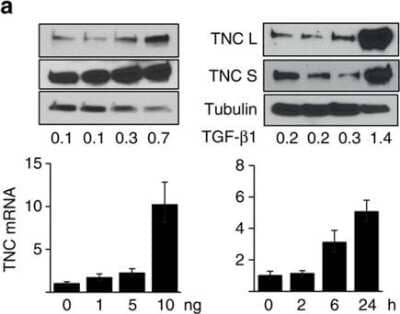 Western Blot: Tenascin C Antibody (4C8MS)BSA Free [NB110-68136]