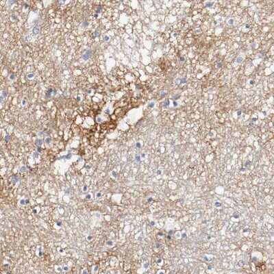 Immunohistochemistry-Paraffin: Tenascin C Antibody [NBP1-89639]