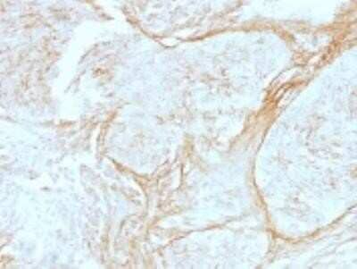 Immunohistochemistry-Paraffin: Tenascin C Antibody (SPM319) - Azide and BSA Free [NBP2-47920]