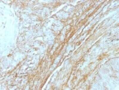 Immunohistochemistry-Paraffin: Tenascin C Antibody (T2H5) - Azide and BSA Free [NBP2-47919]