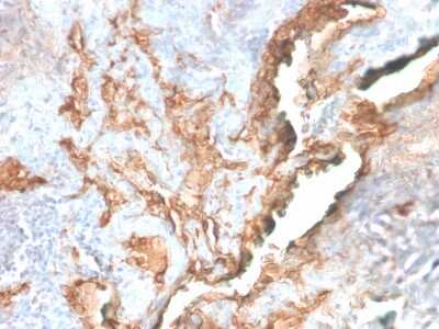 Immunohistochemistry-Paraffin: Tenascin C Antibody (TNC/2981R) - Azide and BSA Free [NBP3-08946]