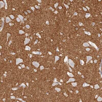 Immunohistochemistry-Paraffin: Tenascin R Antibody [NBP1-86350]