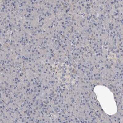 Immunohistochemistry-Paraffin: Tenascin R Antibody [NBP1-86350]