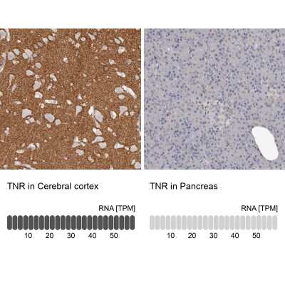 Immunohistochemistry-Paraffin: Tenascin R Antibody [NBP1-86350]