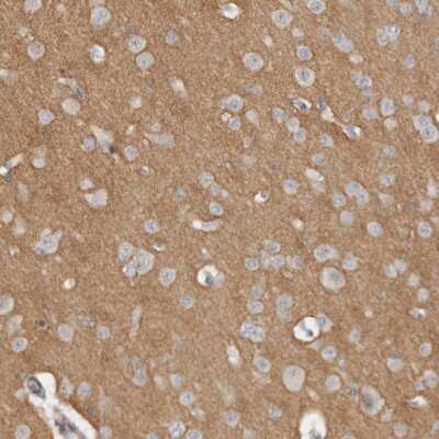 Immunohistochemistry-Paraffin: Tenascin R Antibody [NBP1-86398]