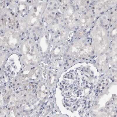 Immunohistochemistry-Paraffin: Tenascin R Antibody [NBP1-86398]