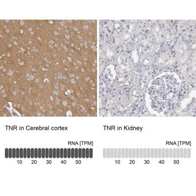 Immunohistochemistry-Paraffin: Tenascin R Antibody [NBP1-86398]